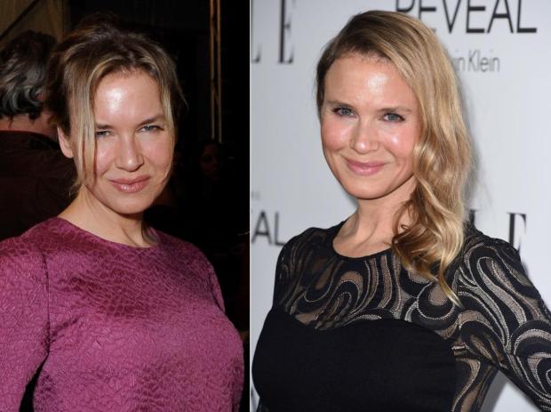 renee-zellweger